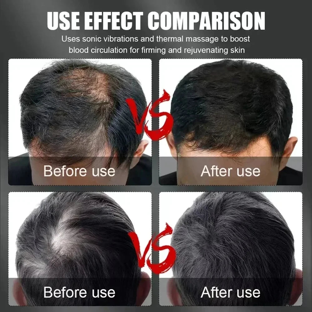660nm 850nm Red Light Infrared Hair Therapy Hair Growth Cap Anti Hair Loss Relax Scalp Care Hat Anti Hairs Adjustable Rear Strap